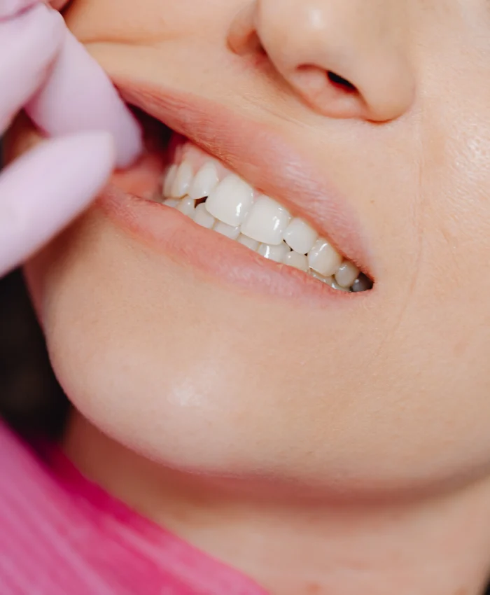 Why Choose Wassif Family & Cosmetic Dentistry for Restorative Dentistry